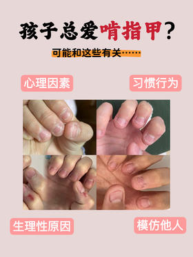 啃啃啃，孩子把指甲都啃秃了……教你这几招来纠正