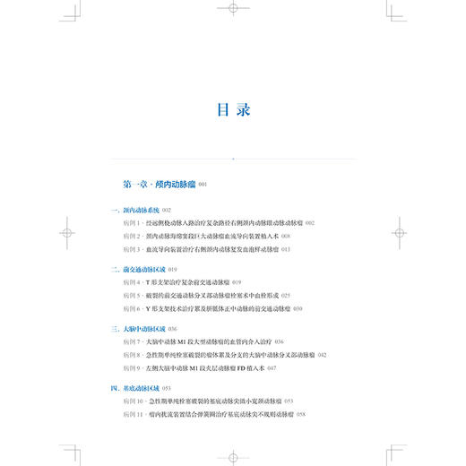 脑血管病介入治疗：OCIN病例精选 刘建民 杨鹏飞 赵开军 适用神经外科和神经内科及相关专业的临床医师、师生 上海科学技术出版社 商品图3