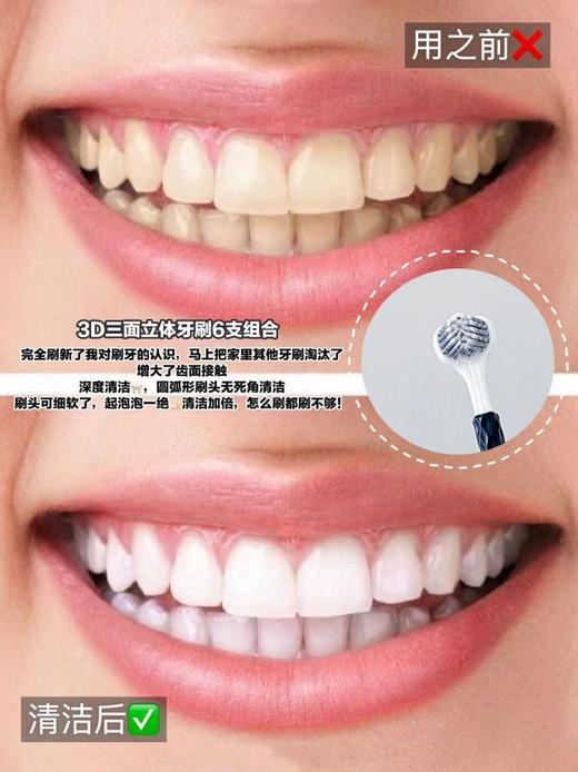 【多妈团购 coobcbl渍齿净护龈三面刷18支】限量活动!360°无死角，三面刷头设计多角度清洁，刷1次顶10次的三面牙刷!省力护牙龈，点型刮舌器，有效清洁舌苔-旺毅 商品图11