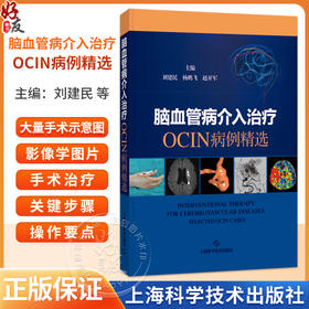 脑血管病介入治疗：OCIN病例精选 刘建民 杨鹏飞 赵开军 适用神经外科和神经内科及相关专业的临床医师、师生 上海科学技术出版社