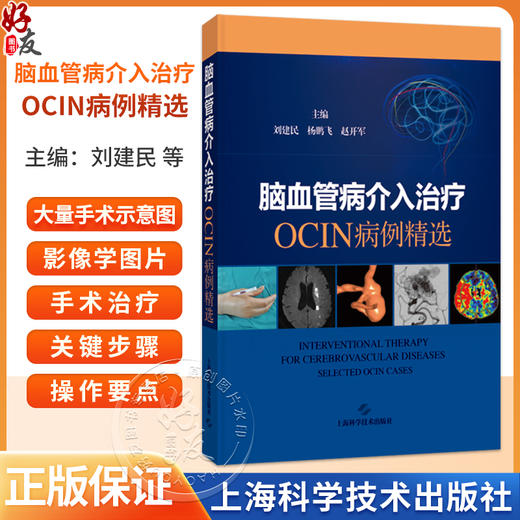 脑血管病介入治疗：OCIN病例精选 刘建民 杨鹏飞 赵开军 适用神经外科和神经内科及相关专业的临床医师、师生 上海科学技术出版社 商品图0
