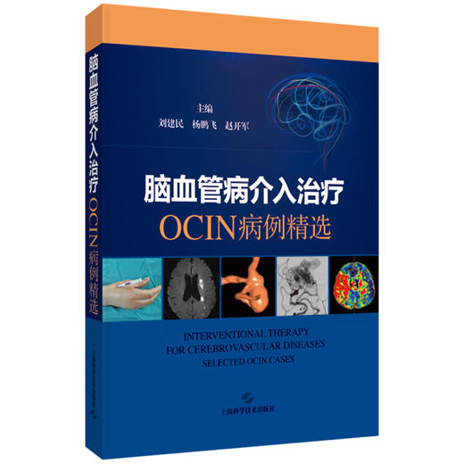 脑血管病介入治疗：OCIN病例精选 刘建民 杨鹏飞 赵开军 适用神经外科和神经内科及相关专业的临床医师、师生 上海科学技术出版社 商品图1