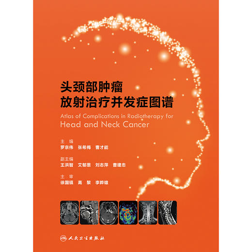 头颈部肿瘤放射治疗并发症图谱 商品图1