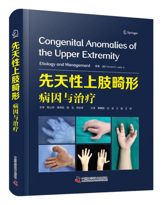 先天性上肢畸形病因与治疗  主译 栗鹏程 刘波 王斌 王欣  辽科出版 商品图0