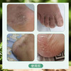 【陈沅堂抑菌液赠真菌快克】真菌困扰救星！ 专攻脚气脱皮瘙痒 草本温和根治 180ml/瓶 商品缩略图4