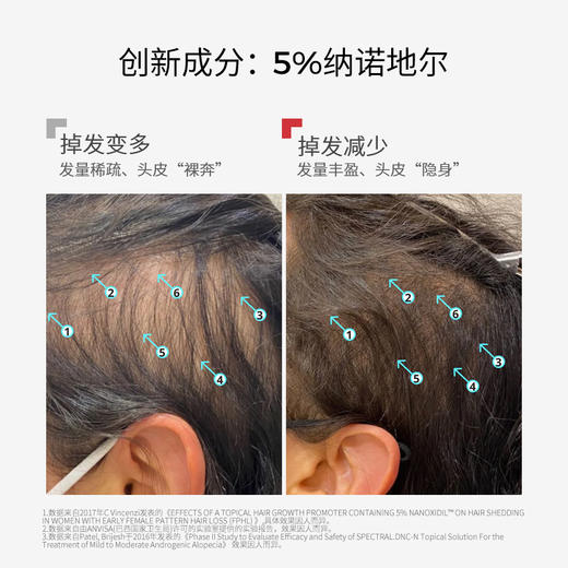 【郑州保税】美国DS Laboratories 女性头皮护理液-紫瓶 60ml/瓶 商品图1