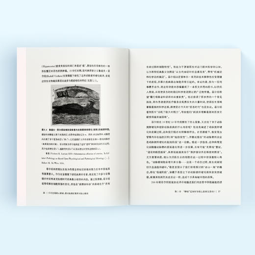 《不可忽视的心脏病：像对抗癌症那样对抗心脏病》 商品图8