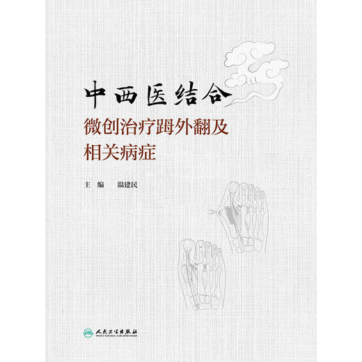 中西医结合微创治疗(足母)外翻及相关病症 商品图1