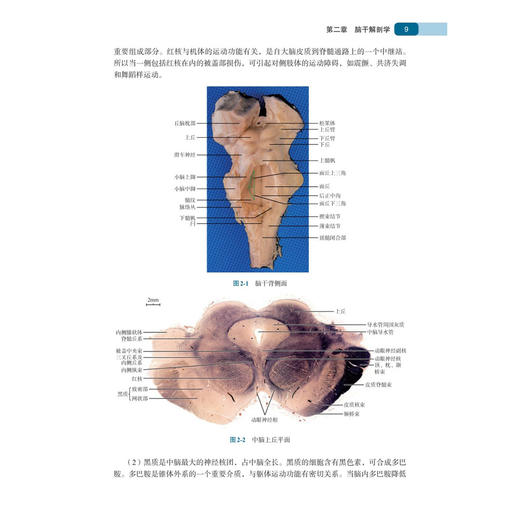 脑干肿瘤外科学 张力伟 主编 可供神经外科、肿瘤科、放射治疗科的临床医生、医学生阅读参考 外科学 9787030833938 科学出版社 商品图4