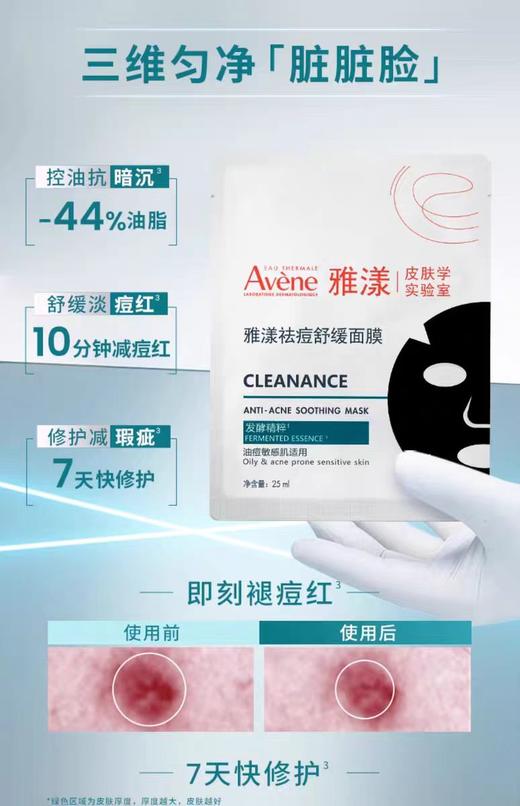雅漾祛痘舒缓面膜25m 商品图1