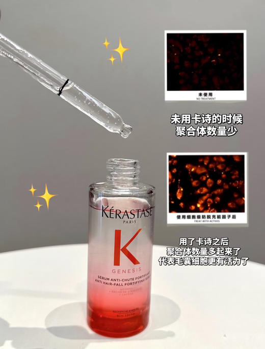 卡诗元气姜精华！防脱头皮精华液固发修复90ml控油维稳防脱 商品图4