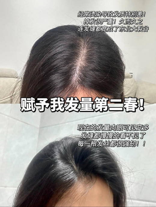 卡诗元气姜精华！防脱头皮精华液固发修复90ml控油维稳防脱 商品图7