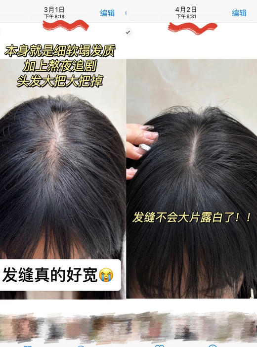 卡诗元气姜精华！防脱头皮精华液固发修复90ml控油维稳防脱 商品图9