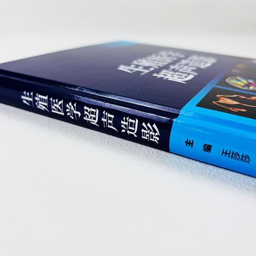 生殖医学超声造影 商品图3