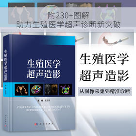 生殖医学超声造影