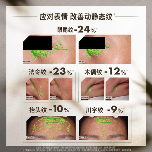 【混知推荐】【50%玻色因溶液抗皱组合】diary言之有物玻色因面霜50g+胶原精华30ml+玻色因维C面霜50g+玻色因维C精华30ml+维k眼霜15g+维k小果咖啡眼油9ml 商品图8