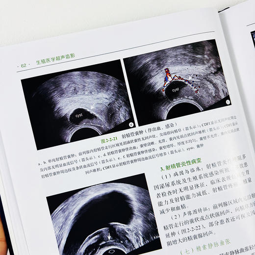 生殖医学超声造影 商品图4