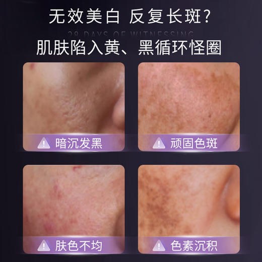 【美白祛斑  改善暗沉】片仔癀皇后牌净妍亮白焕颜霜2.0|保湿提亮肤色祛斑美白霜50g*2 商品图2