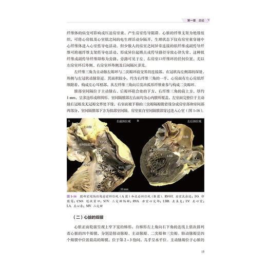 儿童心律失常电生理检查与射频消融治疗 泮思林 高路 主编 小儿疾病 心律失常 电生理学 检查 射频 导管治疗 北京大学医学出版社 商品图4