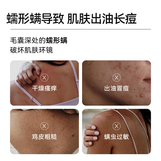 满婷除螨液体香皂480ml*3——加入会员下单享8折，满69元送满婷清满保湿洁面乳，满119元送祛痘控油沐浴乳 商品图2