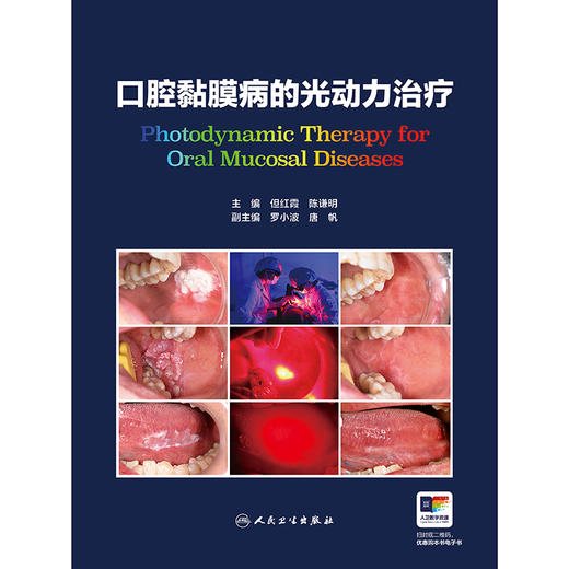 口腔黏膜病的光动力治疗 商品图1