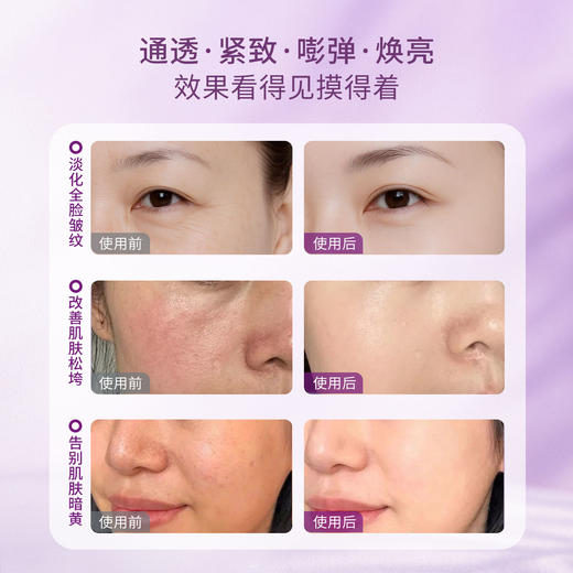 【可程专属】轻龄堂千日菊灵芝多肽面部提拉精华油 10ML/30ML 【佳人严选】 商品图3