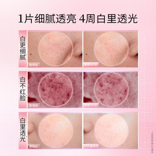 严选 | 凌博士焕凌光透美白淡斑面膜5片*3盒（美白面膜） 商品图3