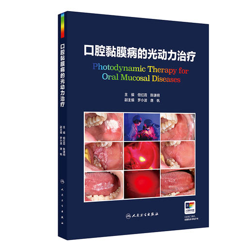 口腔黏膜病的光动力治疗 商品图0