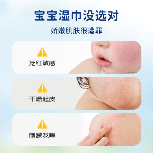 喜宝（HiPP）港版婴儿湿纸巾擦手口清洁屁屁亲肤温和新生儿湿巾 48张*5包/袋 商品图2