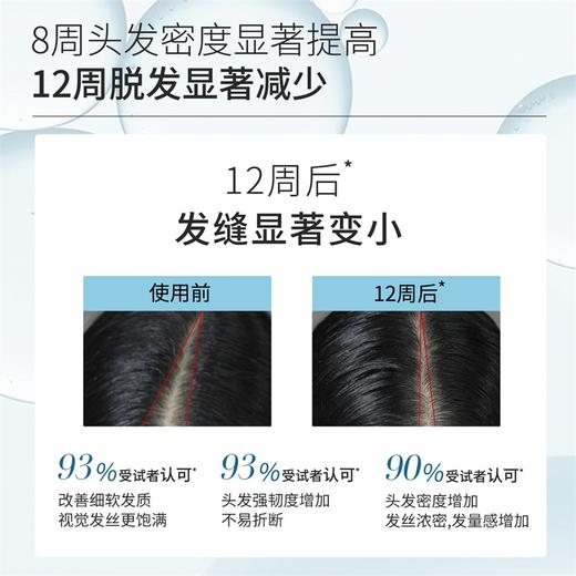 瑞士豌豆苗防脱洗发水强韧发根控油蓬松女男Fortro赋强育发洗发露 商品图2
