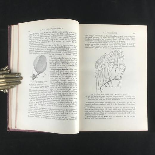 1923年 格林病理学与病理解剖学指南 配版画插图 漆布精装大32开 商品图8