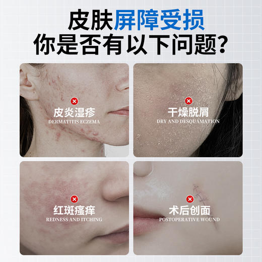 安泰宁医用透明质酸钠修复敷料  30g/支 商品图1