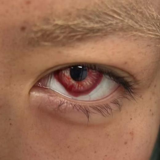 cococon半年抛美瞳 血蚀残瞳 14.5mm 商品图0