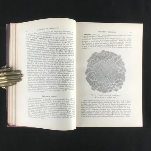 1923年 格林病理学与病理解剖学指南 配版画插图 漆布精装大32开 商品图10