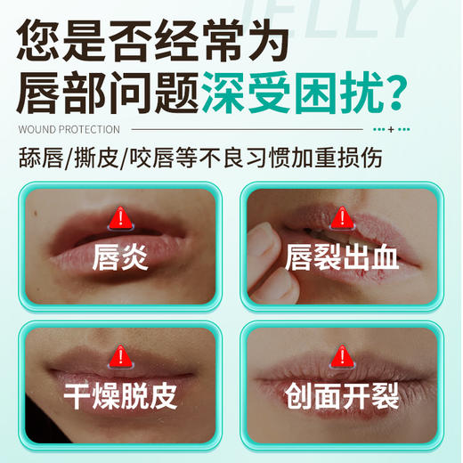 益口宁 医用聚乙二醇润护敷料  10ml/一支 商品图1