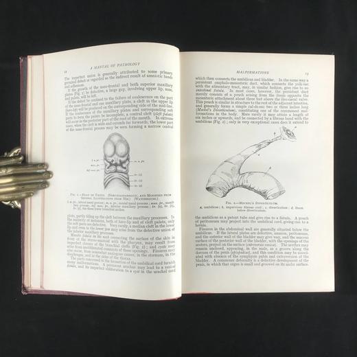 1923年 格林病理学与病理解剖学指南 配版画插图 漆布精装大32开 商品图7