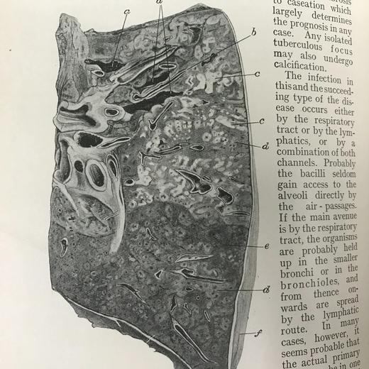 1923年 格林病理学与病理解剖学指南 配版画插图 漆布精装大32开 商品图12