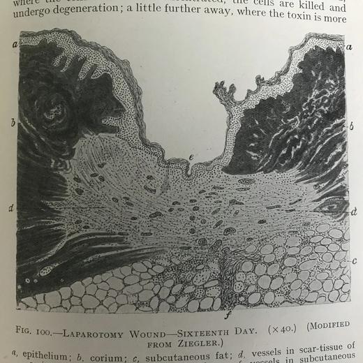 1923年 格林病理学与病理解剖学指南 配版画插图 漆布精装大32开 商品图13