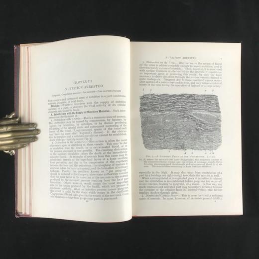 1923年 格林病理学与病理解剖学指南 配版画插图 漆布精装大32开 商品图9