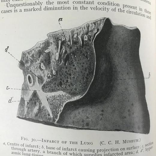 1923年 格林病理学与病理解剖学指南 配版画插图 漆布精装大32开 商品图11