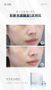 冰月岚冰润水光针10支装/盒 深层补水让肌肤告别暗黄，实现水润透亮 商品缩略图0