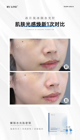 冰月岚冰润水光针10支装/盒 深层补水让肌肤告别暗黄，实现水润透亮
