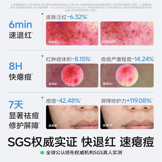 海龟爸爸 双萃修护祛痘精华液次抛急救瘪痘青少年控油去痘防反复淡化红痘印 商品图2