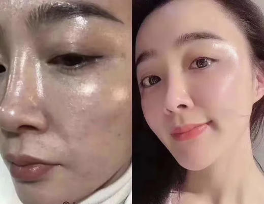 【纯积分兑换】男士/女士均可💦抗衰老/补水/祛斑/祛痘/嫩白/修复/私人订制/护肤一次/新加坡妆品体验-可多拍-每人最高使用2次-务必加微预约-15371633811 商品图10