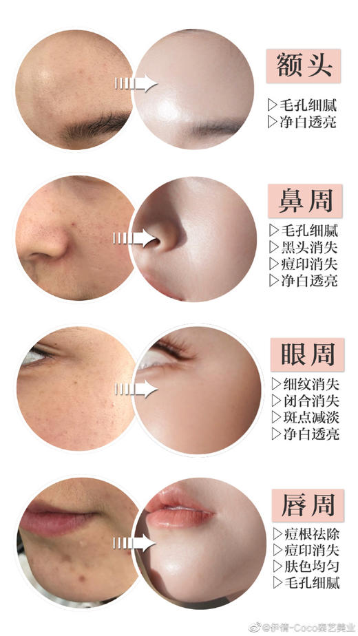 【纯积分兑换】男士/女士均可💦抗衰老/补水/祛斑/祛痘/嫩白/修复/私人订制/护肤一次/新加坡妆品体验-可多拍-每人最高使用2次-务必加微预约-15371633811 商品图11