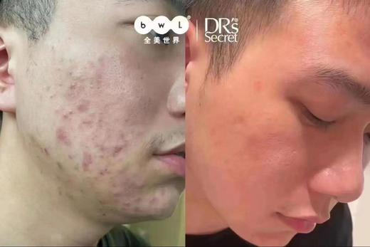 【纯积分兑换】男士/女士均可💦抗衰老/补水/祛斑/祛痘/嫩白/修复/私人订制/护肤一次/新加坡妆品体验-可多拍-每人最高使用2次-务必加微预约-15371633811 商品图13