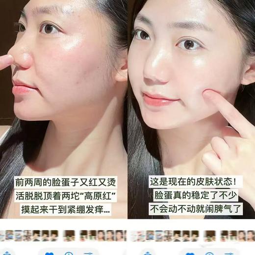 [超好用] 薇诺娜舒敏保湿特护面膜 改善泛红修护屏障敏感肌面膜 商品图5