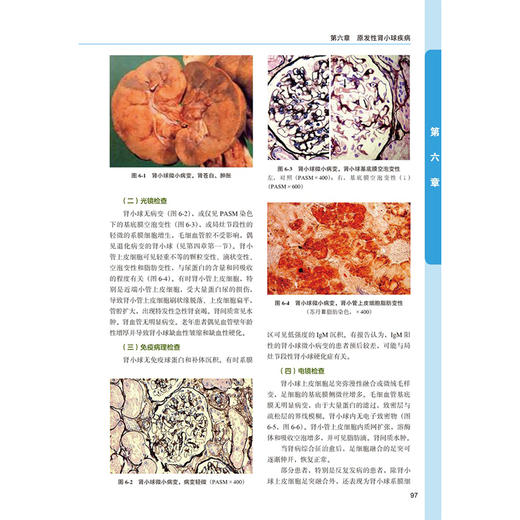 肾活检病理学第6六版 邹万忠 包含北京大学病理学系第一医院肾内科和肾脏疾病研究所多年积累的大量肾活检等资料北京大学医学出版社 商品图4