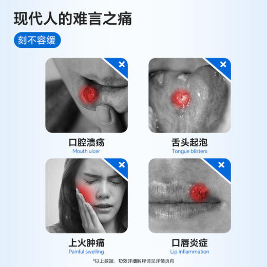 复因医用口腔溃疡含漱液 15mL*10袋 商品图1