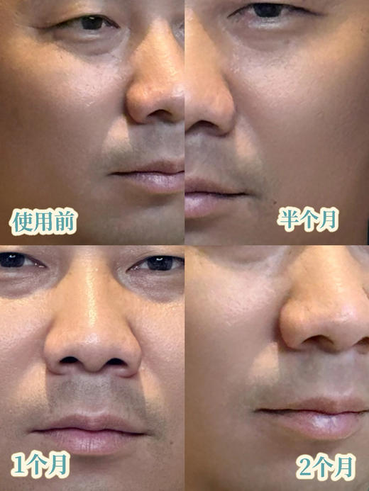 【纯积分兑换】男士/女士均可💦抗衰老/补水/祛斑/祛痘/嫩白/修复/私人订制/护肤一次/新加坡妆品体验-可多拍-每人最高使用2次-务必加微预约-15371633811 商品图14